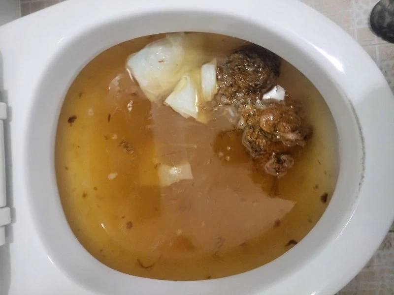 "변기에 버려도 되는 물티슈" 정말 괜찮을까